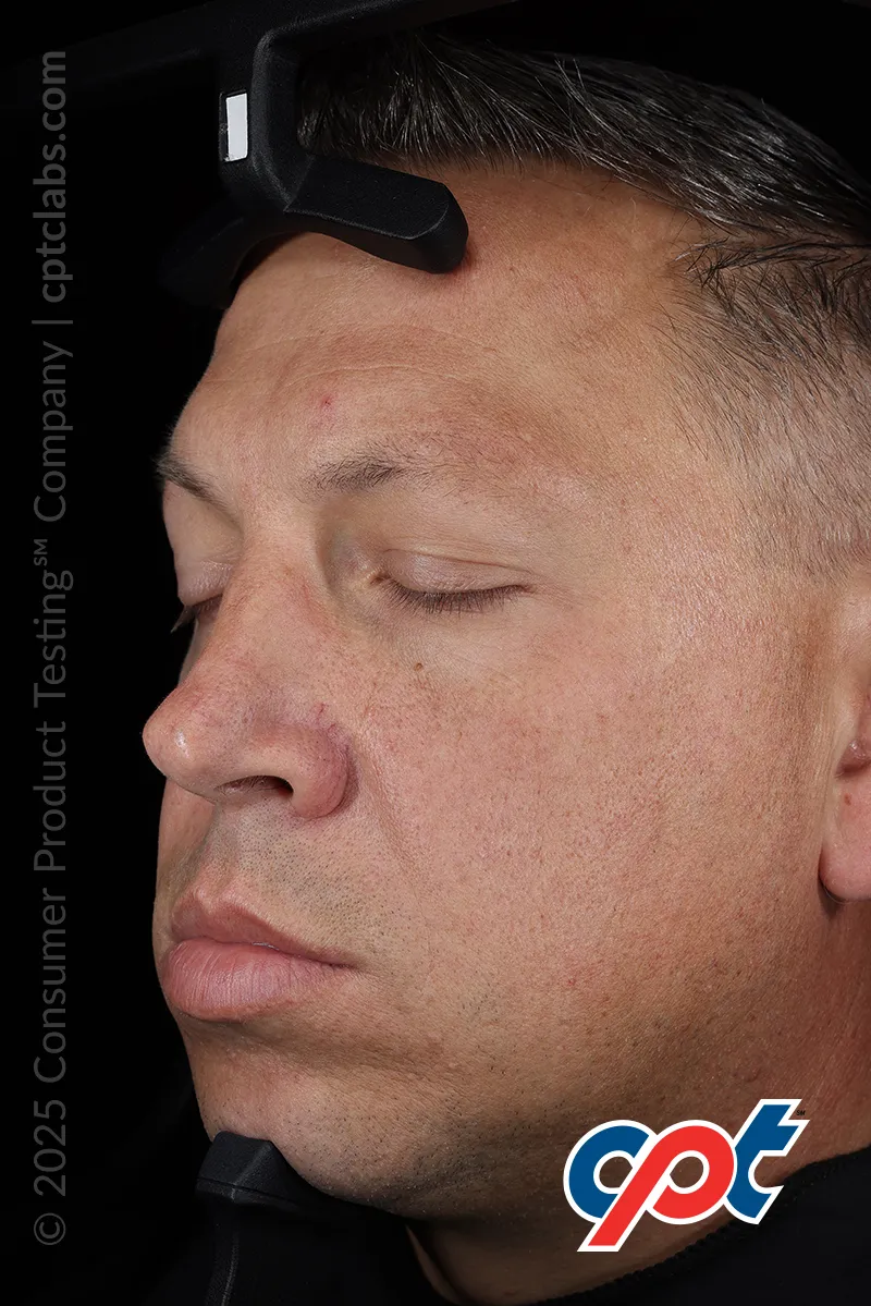 Lighting Mode: Standard 1
General Purpose White Light used for analysis of Spots, Pores, Texture, and Wrinkles