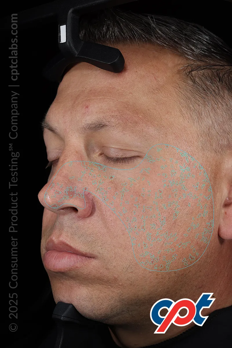 Analysis: Spots