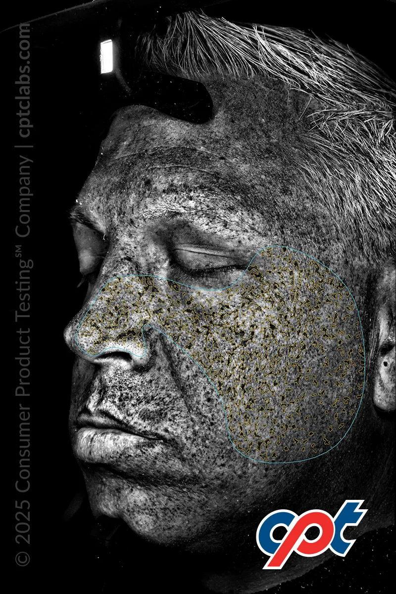 Lighting Mode: UV Fluorescence (processed)
Analysis: UV Spots